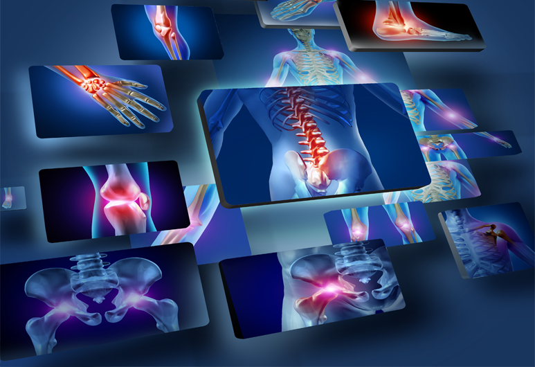 Artificial intelligence